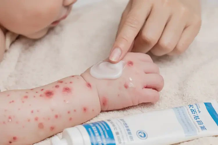 新生兒手臂容易起濕疹可不可以徹底自愈(圖3)
