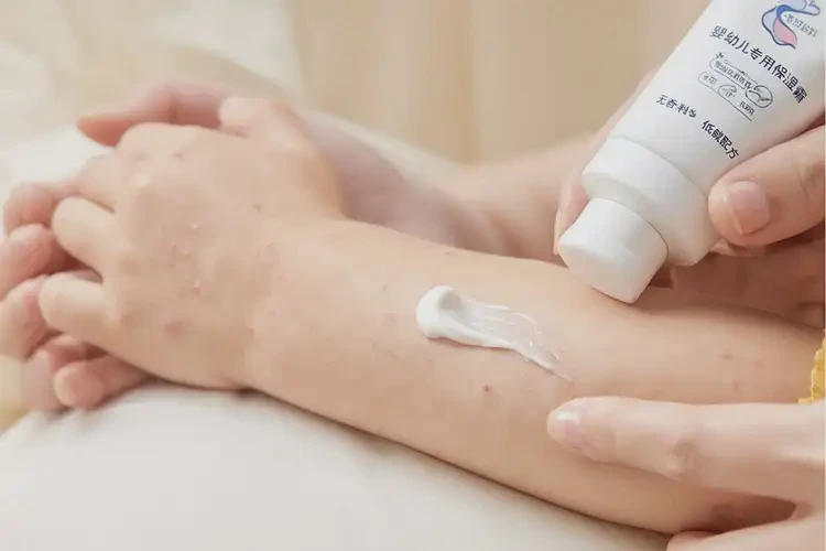 嬰幼兒手臂有濕疹可不可以徹底自愈(圖3)