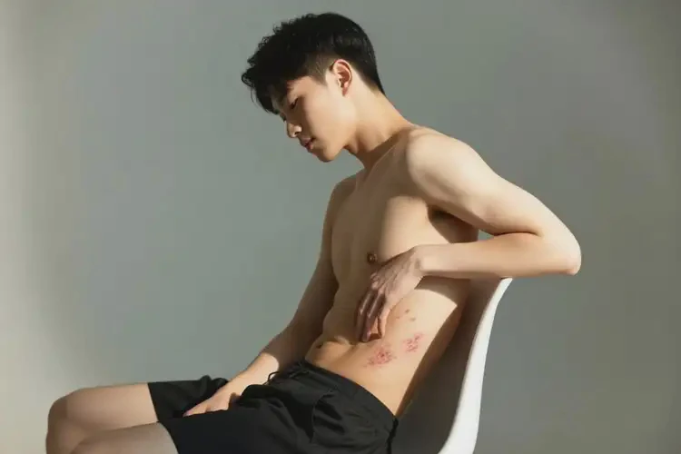 青年人肚子上偶爾起濕疹能徹底自愈嗎(圖2)