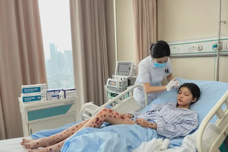 產(chǎn)婦全身出現(xiàn)濕疹能靠自己自愈嗎(圖3)