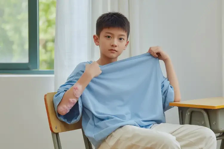 中學(xué)生手臂上經(jīng)常起濕疹能靠自己自愈嗎(圖1)