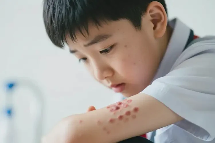 中學(xué)生身上出濕疹不管它會自己痊愈嗎(圖1)