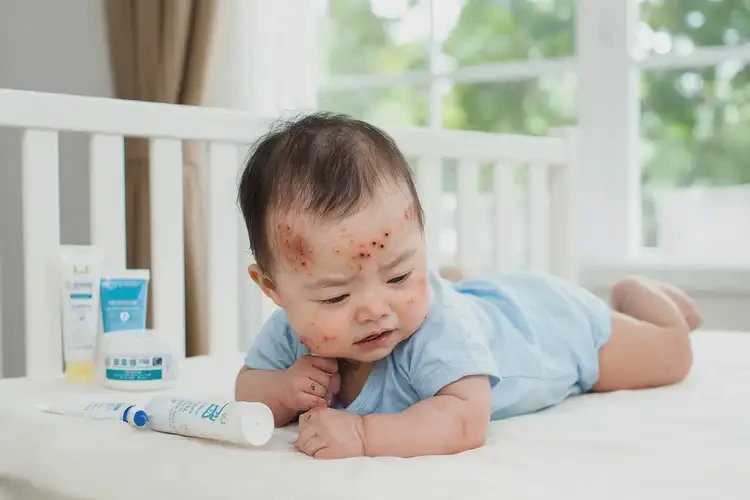 嬰兒脖子經(jīng)常起濕疹能夠徹底治愈嗎(圖4)