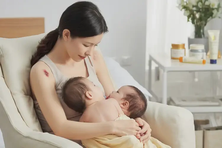 哺乳期媽媽四肢經(jīng)常長濕疹能不能徹底自愈(圖4)