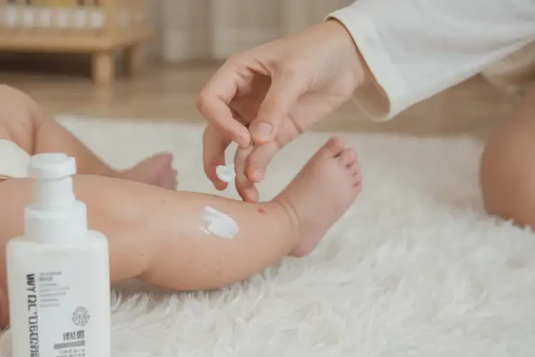 嬰兒小腿上起濕疹能靠自己自愈嗎(圖4)