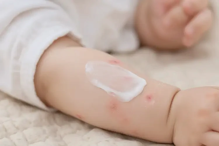 宝宝手臂上偶尔长湿疹不管它会自己痊愈吗(图3)