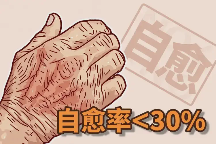 老人手上容易起濕疹能徹底自愈嗎(圖1)