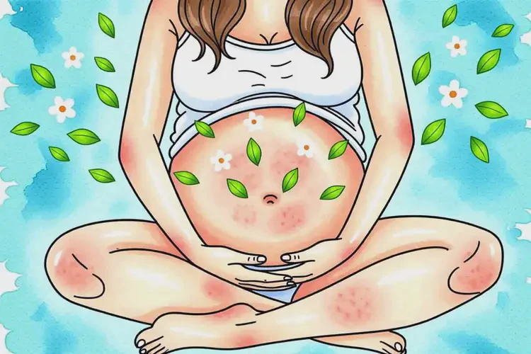 女生肚子長濕疹可不可以徹底自愈(圖4)