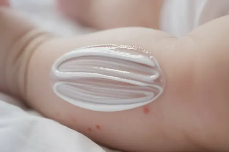 寶寶小腿上經(jīng)常長濕疹不管它會(huì)自己痊愈嗎(圖1)