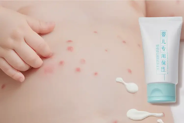 小兒屁股上出現(xiàn)濕疹可以徹底自愈嗎(圖4)