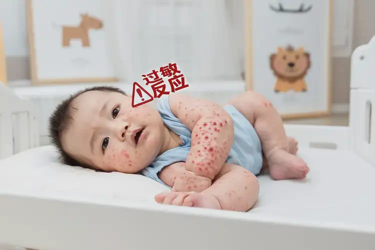 嬰兒屁股經(jīng)常長濕疹不管它會自己自愈嗎(圖4)