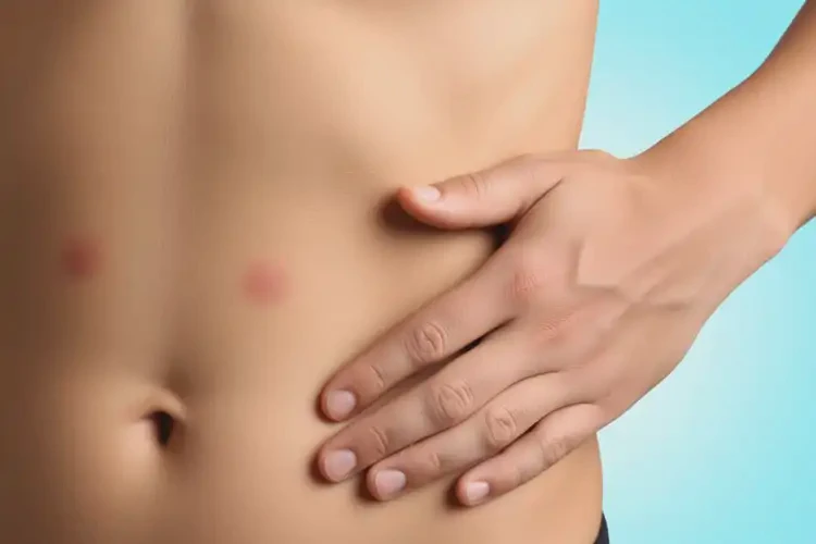 青少年肚子上經(jīng)常起濕疹不管它會自己好嗎(圖4)