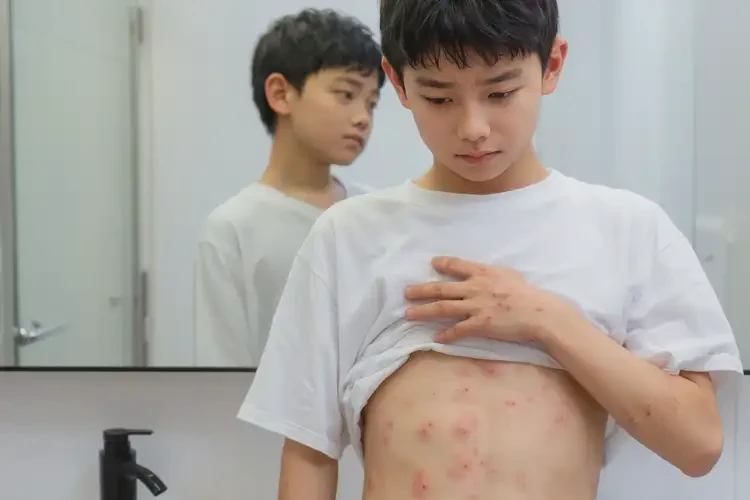 大學(xué)生肚子上偶爾長濕疹不管它會(huì)自己自愈嗎(圖4)