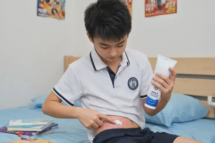 中學(xué)生肚子經(jīng)常長濕疹可以徹底自愈嗎(圖4)