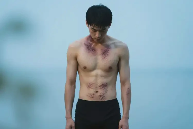 男生全身經(jīng)常長濕疹能徹底自愈嗎(圖2)