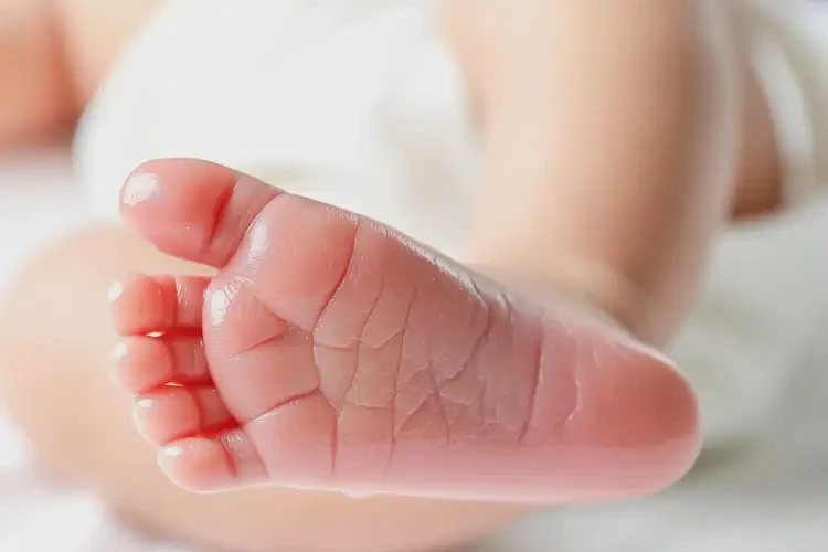 嬰兒身上偶爾長濕疹可以徹底自愈嗎(圖1)