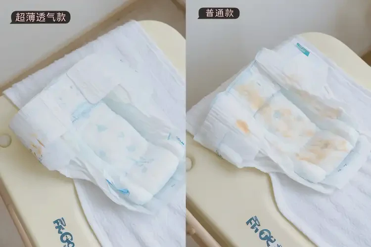 新生兒屁股起濕疹能徹底自愈嗎(圖2)