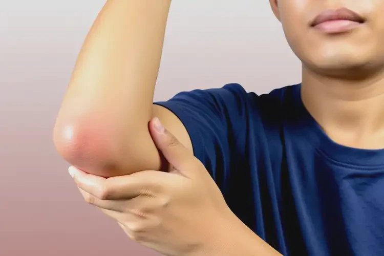 大學生手臂經常起濕疹能不能徹底自愈(圖1)