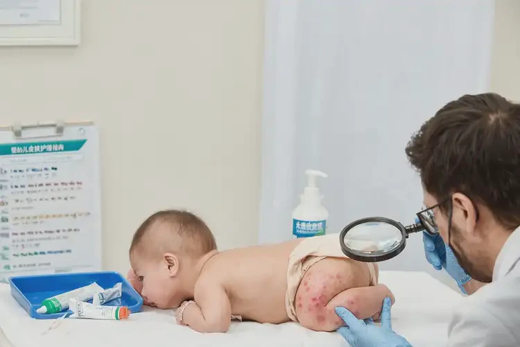 小兒肛周出濕疹能靠自己自愈嗎(圖4)