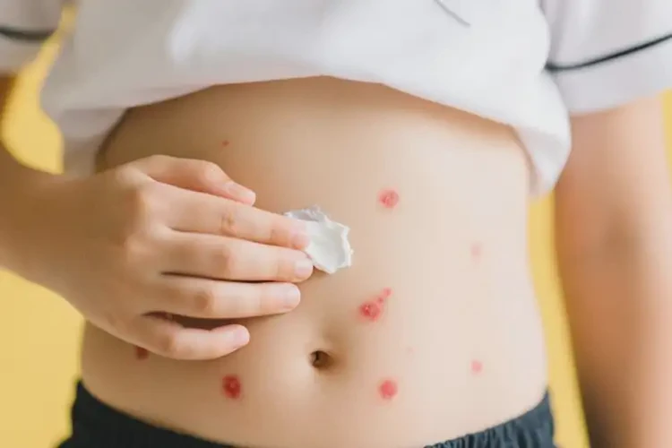 小學(xué)生肚子上偶爾長(zhǎng)濕疹能夠徹底治愈嗎(圖4)