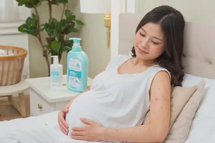 產(chǎn)婦屁股偶爾起濕疹不管它會(huì)自己好嗎(圖3)