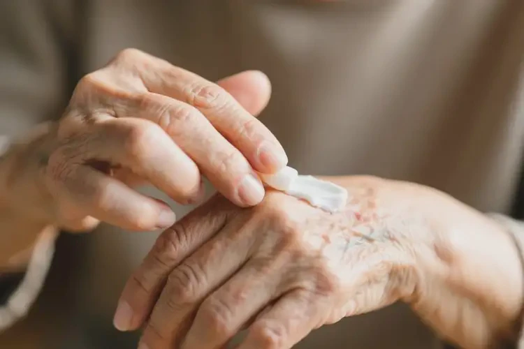 老年人身上偶爾起濕疹能夠徹底治愈嗎(圖2)