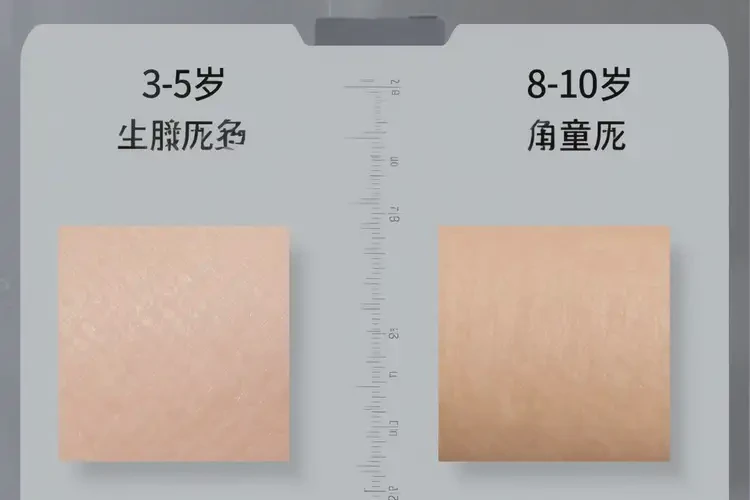 孩子肛周偶尔起湿疹能彻底自愈吗(图2)