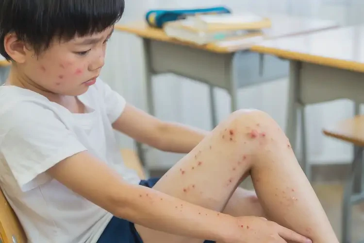 小學(xué)生大腿上偶爾起濕疹不管它會自己好嗎(圖4)