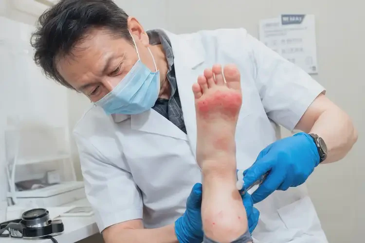 小兒腳上長(zhǎng)濕疹能靠自己自愈嗎(圖2)