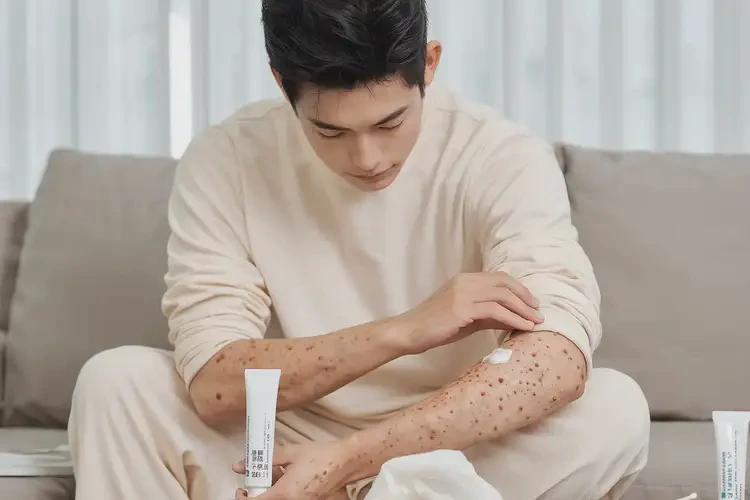 青年人大腿起濕疹可以徹底自愈嗎(圖1)