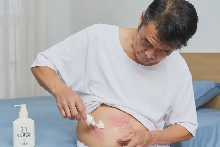 男生肚子起濕疹不管它會(huì)自己痊愈嗎(圖3)