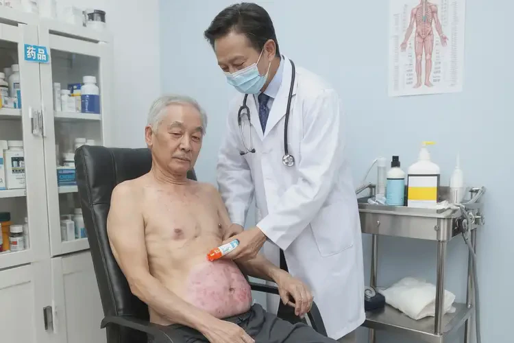高齡老人肚子出現(xiàn)濕疹能不能徹底自愈(圖3)