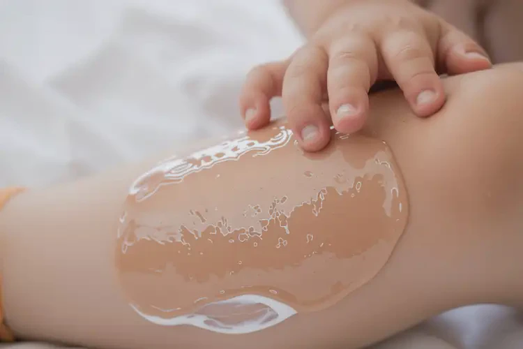 孩子小腿上出現(xiàn)濕疹不管它會自己自愈嗎(圖2)