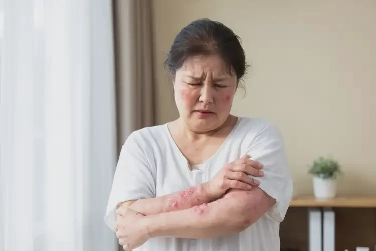 女性臉上偶爾長濕疹不管它會自己痊愈嗎(圖3)