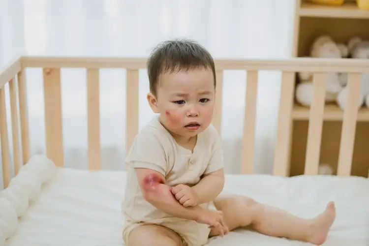 幼兒肚子上偶爾長濕疹不管它會(huì)自己好嗎(圖3)