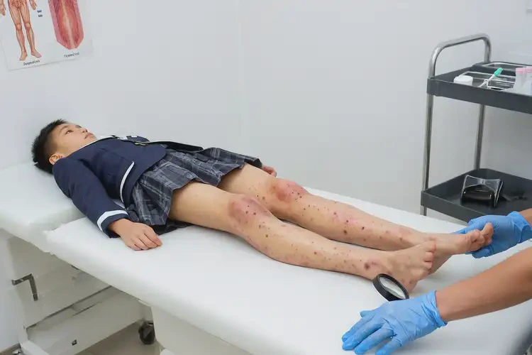 中學生小腿出現(xiàn)濕疹不管它會自己痊愈嗎(圖3)