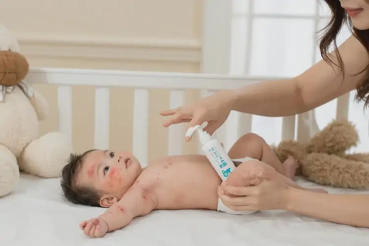 嬰兒手上出現(xiàn)濕疹能靠自己自愈嗎(圖1)