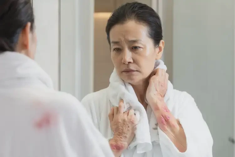 女性全身偶爾長(zhǎng)濕疹不管它會(huì)自己自愈嗎(圖4)