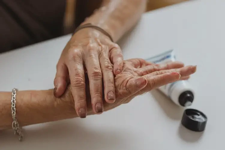 哺乳期妈妈手上起湿疹不管它会自己好吗(图4)