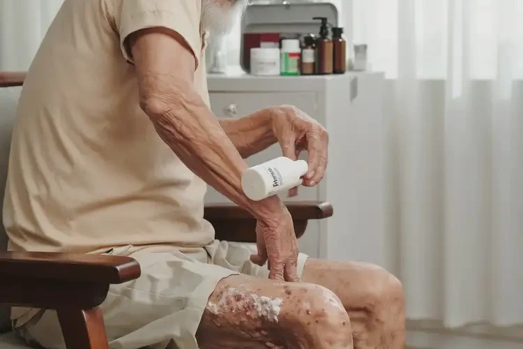 老年人小腿上出湿疹能不能彻底自愈(图2)