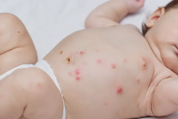 嬰兒肚子長濕疹能夠徹底治愈嗎(圖4)