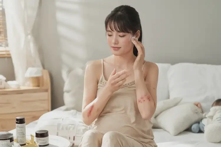 產(chǎn)婦全身偶爾起濕疹不管它會自己自愈嗎(圖4)