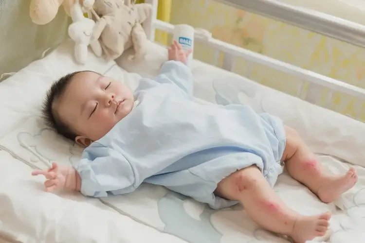 新生兒臉上長(zhǎng)濕疹不管它會(huì)自己痊愈嗎(圖3)