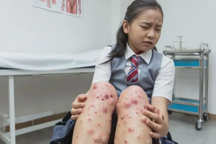 中學生大腿出現(xiàn)濕疹可不可以徹底自愈(圖3)