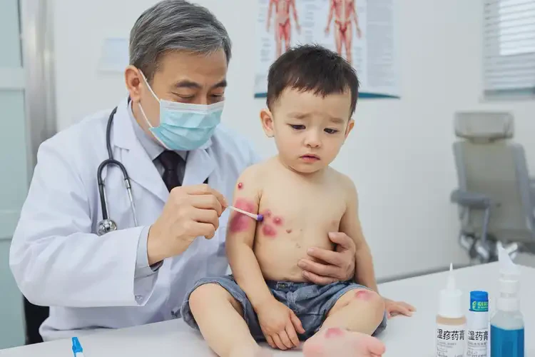 少兒四肢起濕疹能夠徹底治愈嗎(圖3)