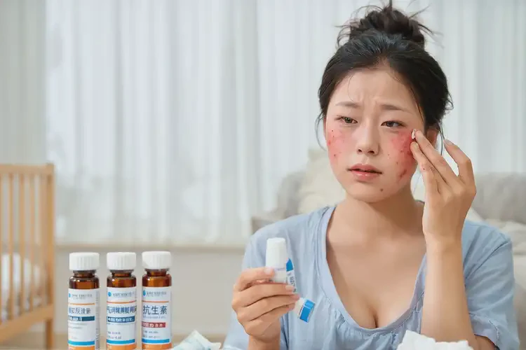 產(chǎn)婦面部長濕疹能夠徹底治愈嗎(圖4)