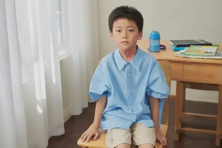 小學(xué)生脖子上有濕疹能徹底自愈嗎(圖2)