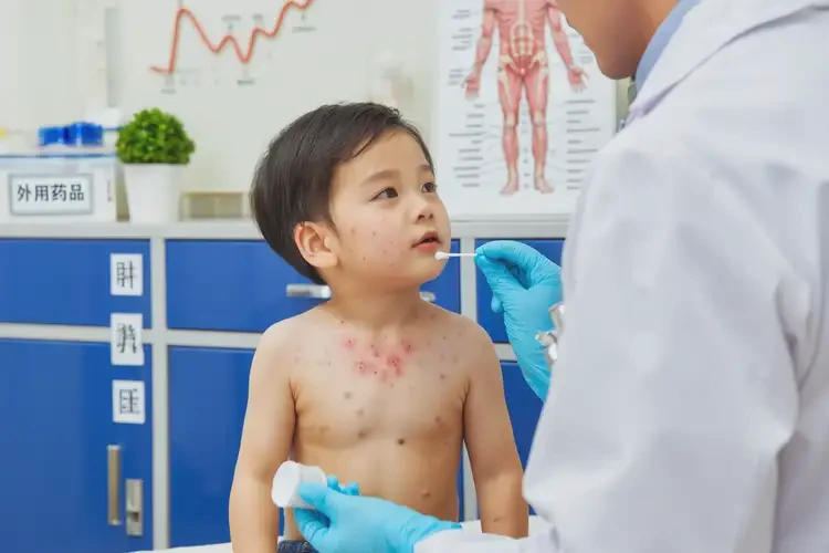 幼兒脖子上容易長(zhǎng)濕疹能徹底自愈嗎(圖3)