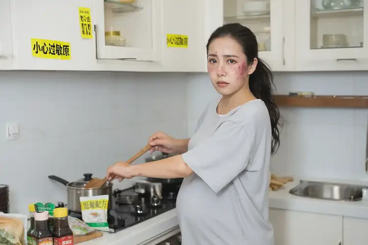 哺乳期媽媽面部偶爾長濕疹不管它會自己自愈嗎(圖2)