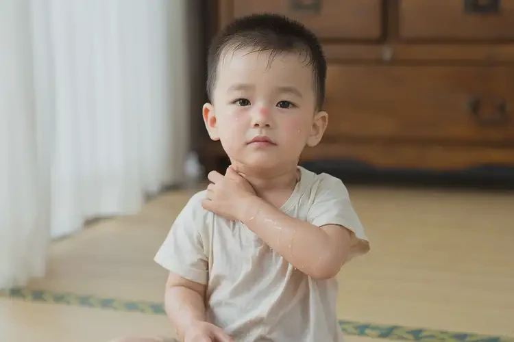 幼兒脖子經(jīng)常起濕疹不管它會自己自愈嗎(圖2)